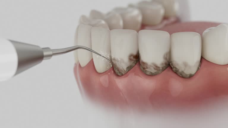 Reliable Dental Implants contractor in Sedalia, MO by Smile Center Dentistry